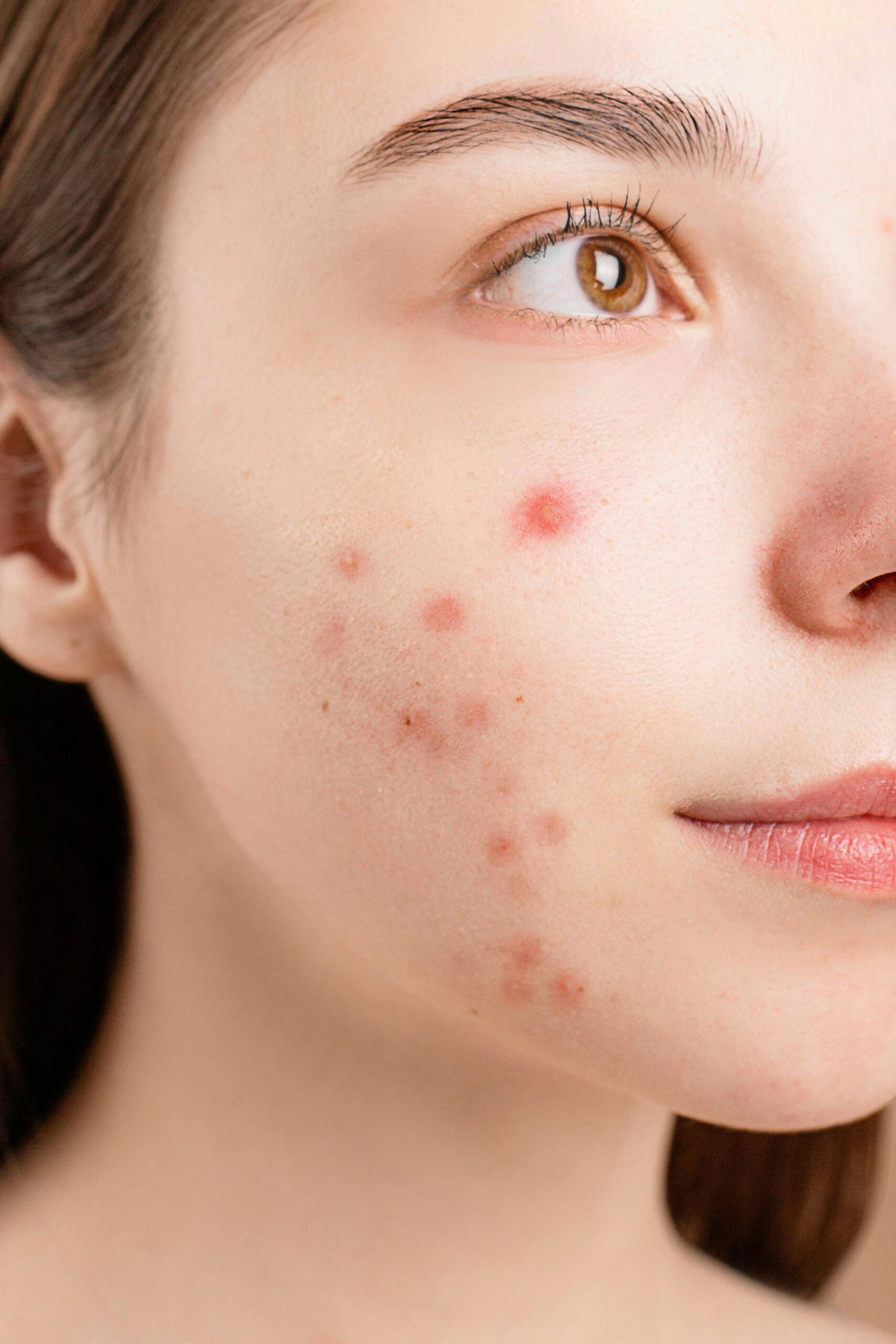 breakouts